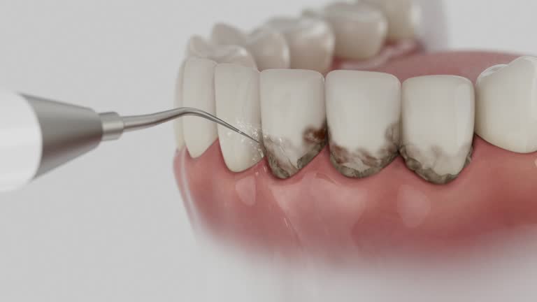 Trusted Teeth Cleaning And Checkup service in Vienna, WV - Dentist Open Now
